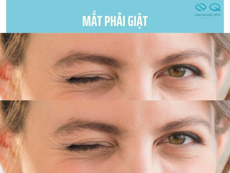 mat phai giat 5 jpg